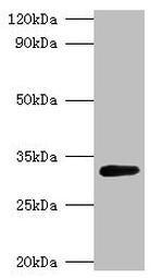 GLSA1 Antibody in Western Blot (WB)