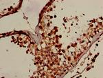 OS9 Antibody in Immunohistochemistry (Paraffin) (IHC (P))