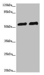 CALCOCO2 Antibody in Western Blot (WB)