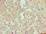 MST2 Antibody in Immunohistochemistry (Paraffin) (IHC (P))