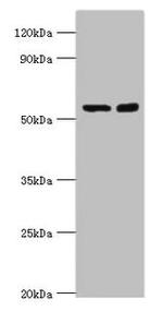 MST2 Antibody in Western Blot (WB)