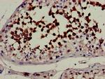 CYP51A1 Antibody in Immunohistochemistry (Paraffin) (IHC (P))