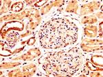 NFATC3 Antibody in Immunohistochemistry (Paraffin) (IHC (P))