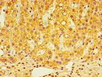 GPS1 Antibody in Immunohistochemistry (Paraffin) (IHC (P))