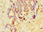 GPS1 Antibody in Immunohistochemistry (Paraffin) (IHC (P))