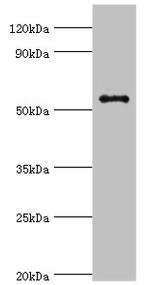 GPS1 Antibody in Western Blot (WB)