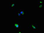 MEK5 Antibody in Immunocytochemistry (ICC/IF)