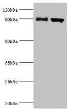 ADAM9 Antibody in Western Blot (WB)