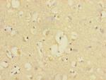 CD226 (DNAM-1) Antibody in Immunohistochemistry (Paraffin) (IHC (P))