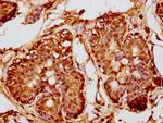 MKP2 Antibody in Immunohistochemistry (Paraffin) (IHC (P))