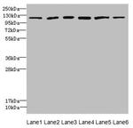 UBE4A Antibody in Western Blot (WB)