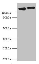 Dynactin 1 Antibody in Western Blot (WB)