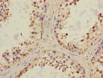 CHRNA6 Antibody in Immunohistochemistry (Paraffin) (IHC (P))