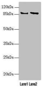 JIP2 Antibody in Western Blot (WB)