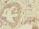 Melan-A Antibody in Immunohistochemistry (Paraffin) (IHC (P))