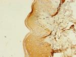 Melan-A Antibody in Immunohistochemistry (Paraffin) (IHC (P))