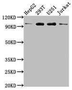 KPNB1 Antibody in Western Blot (WB)