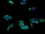 LRP8 Antibody in Immunocytochemistry (ICC/IF)