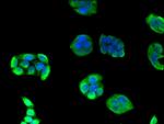 eIF3a Antibody in Immunocytochemistry (ICC/IF)