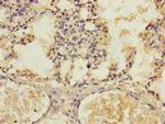 KIZUNA Antibody in Immunohistochemistry (Paraffin) (IHC (P))