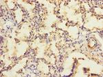 KIZUNA Antibody in Immunohistochemistry (Paraffin) (IHC (P))