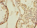 KIZUNA Antibody in Immunohistochemistry (Paraffin) (IHC (P))