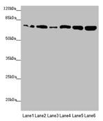 KIZUNA Antibody in Western Blot (WB)