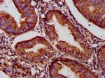 C5orf33 Antibody in Immunohistochemistry (Paraffin) (IHC (P))