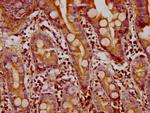 FMN1 Antibody in Immunohistochemistry (Paraffin) (IHC (P))