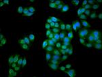 C1orf69 Antibody in Immunocytochemistry (ICC/IF)