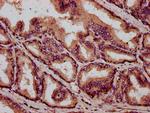 C1orf69 Antibody in Immunohistochemistry (Paraffin) (IHC (P))