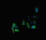 PPP2R2D Antibody in Immunocytochemistry (ICC/IF)