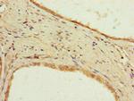 PPP2R2D Antibody in Immunohistochemistry (Paraffin) (IHC (P))