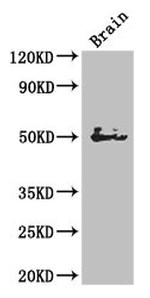 SPOCK1 Antibody in Western Blot (WB)