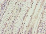 DUSP13 Antibody in Immunohistochemistry (Paraffin) (IHC (P))