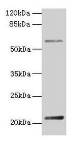 DUSP13 Antibody in Western Blot (WB)