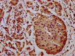 ICB-1 Antibody in Immunohistochemistry (Paraffin) (IHC (P))