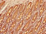 SLC16A9 Antibody in Immunohistochemistry (Paraffin) (IHC (P))