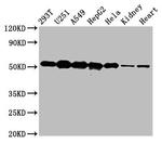 SLC25A24 Antibody in Western Blot (WB)