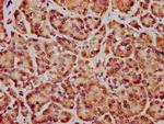 FRMD7 Antibody in Immunohistochemistry (Paraffin) (IHC (P))