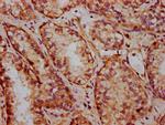 FRMD7 Antibody in Immunohistochemistry (Paraffin) (IHC (P))