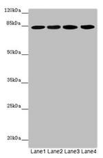 LRSAM1 Antibody in Western Blot (WB)