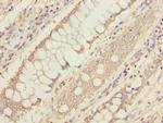 MTHFD1L Antibody in Immunohistochemistry (Paraffin) (IHC (P))