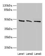 HSDL2 Antibody in Western Blot (WB)