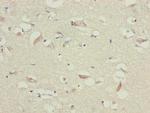 TTLL7 Antibody in Immunohistochemistry (Paraffin) (IHC (P))