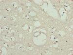 TTLL7 Antibody in Immunohistochemistry (Paraffin) (IHC (P))