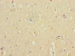 ANKS1B Antibody in Immunohistochemistry (Paraffin) (IHC (P))