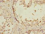 ANKS1B Antibody in Immunohistochemistry (Paraffin) (IHC (P))