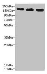 ANKS1B Antibody in Western Blot (WB)