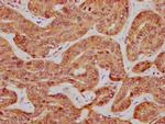 ILDR1 Antibody in Immunohistochemistry (Paraffin) (IHC (P))